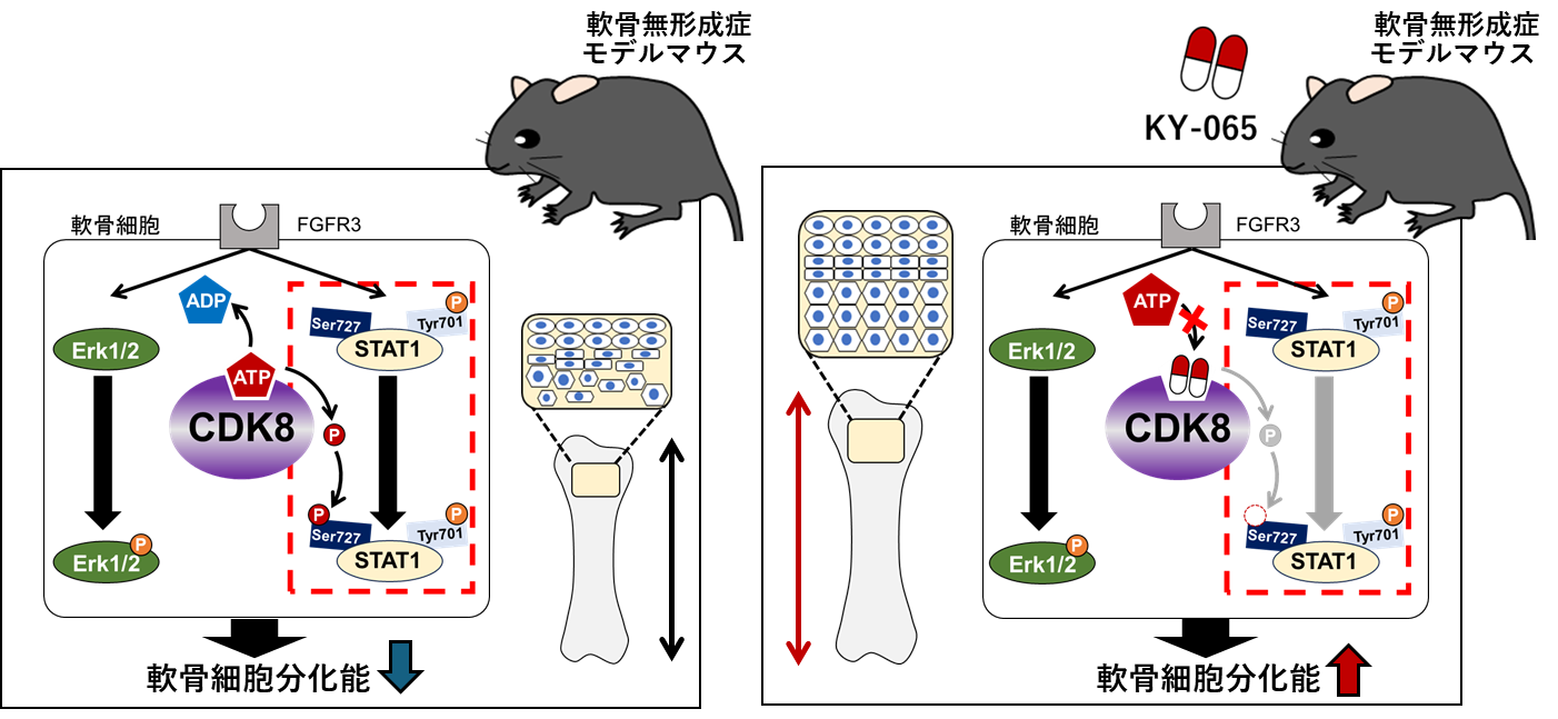 軟骨無形成症の新規治療薬候補としてCDK8阻害剤発見 岐阜薬科